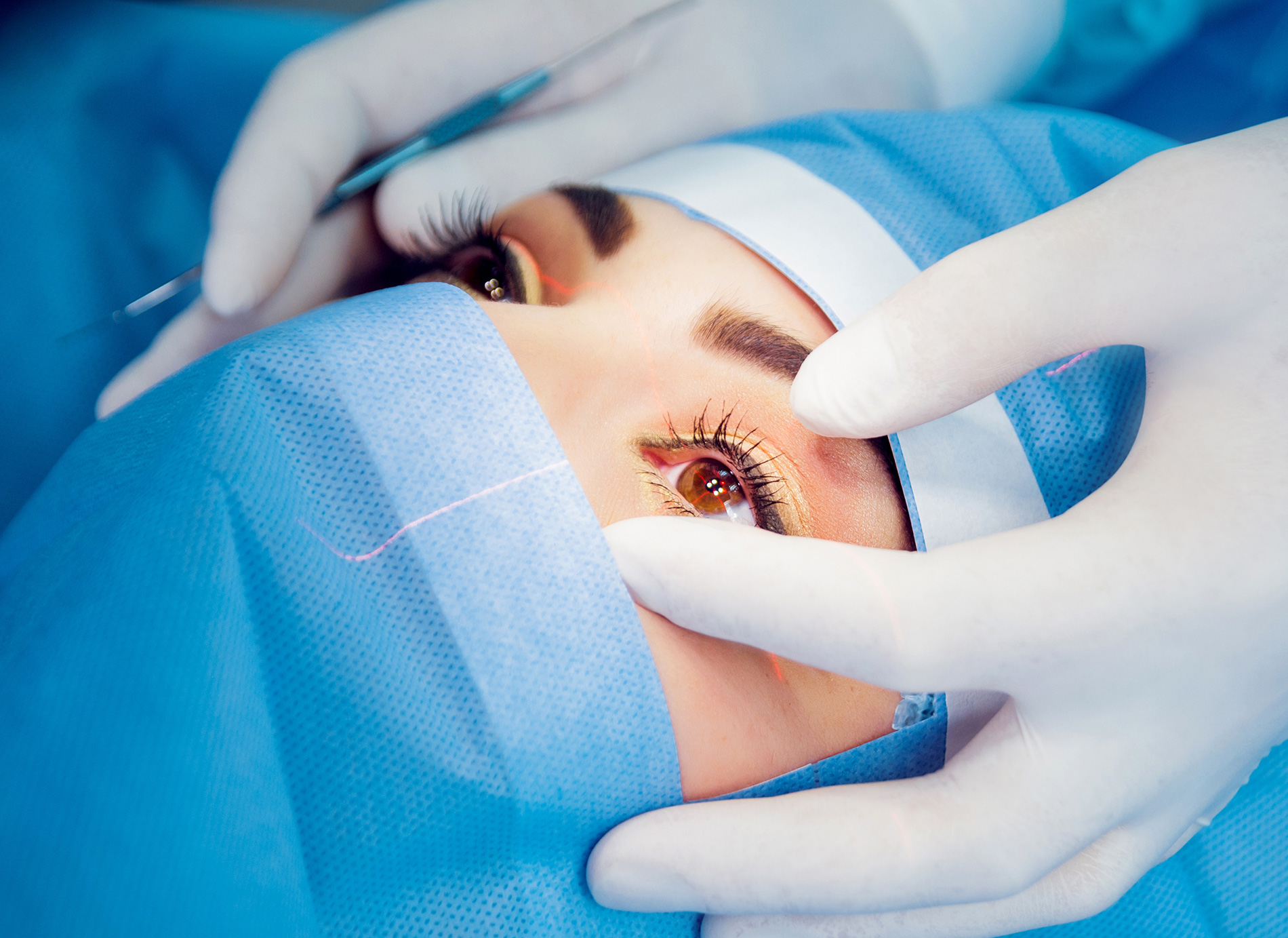 علاج إعتام عدسة العين عن طريق جراحة الساد
