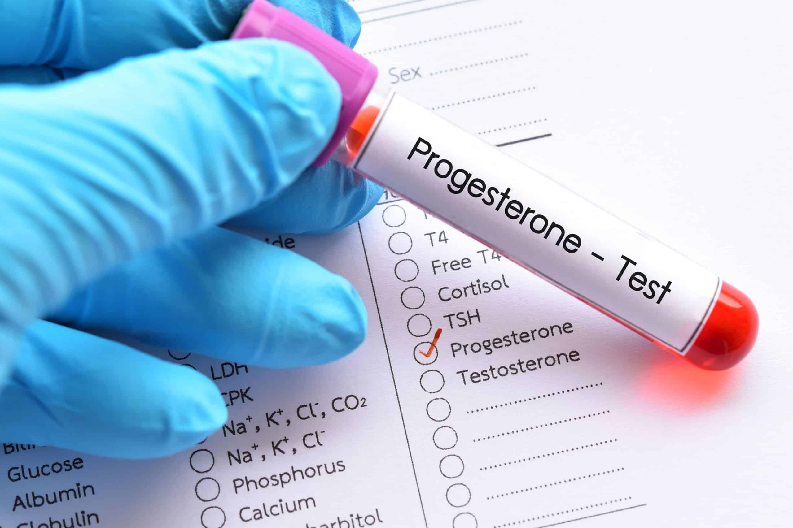 تحليل هرمون اختبار البروجسترون