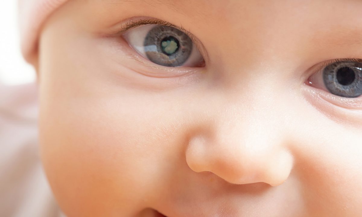 إعتام عدسة العين عند الأطفال الأعراض وطرق العلاج
