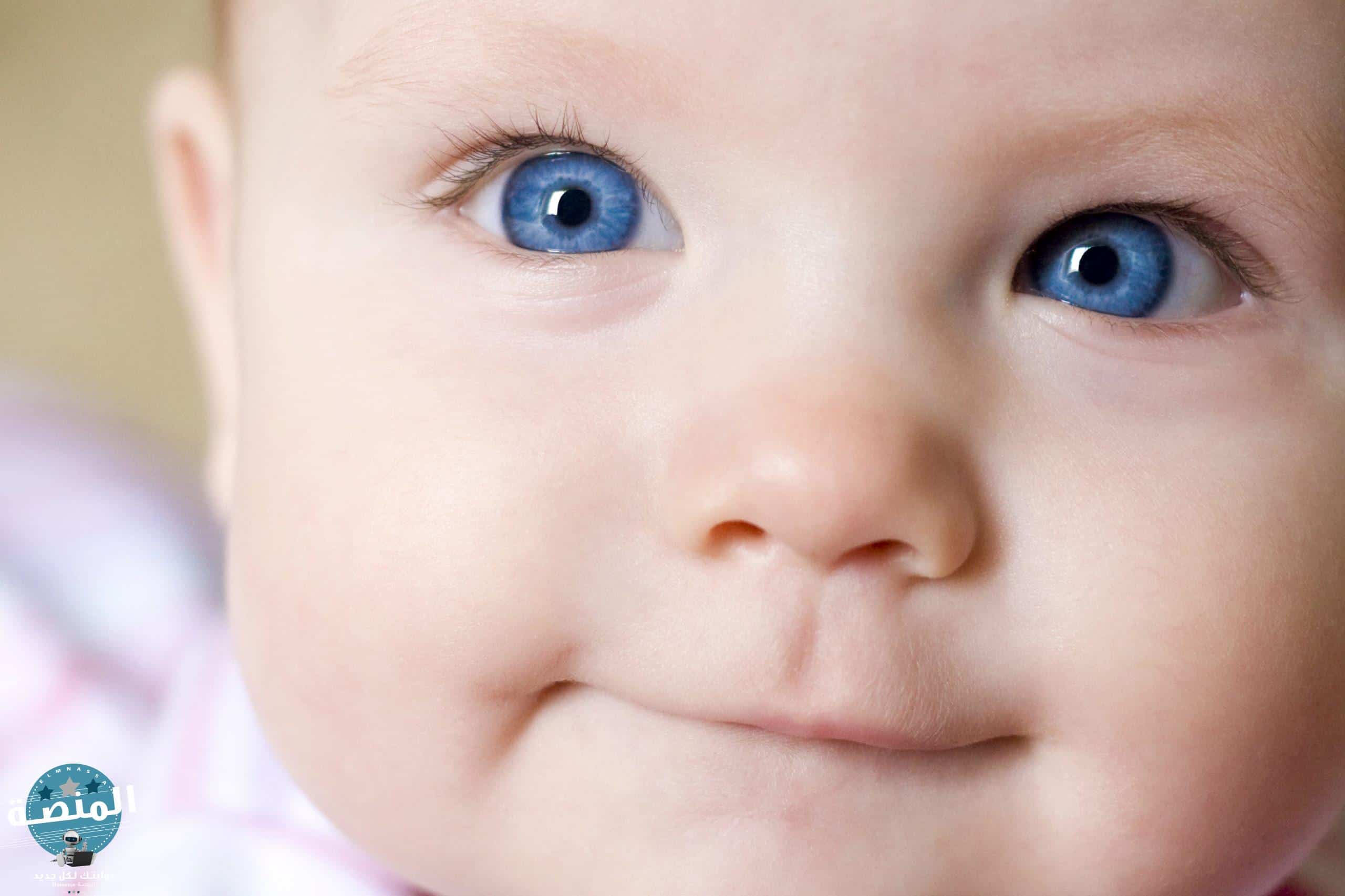 أعراض الجلوكوما عند الأطفال والرضع
