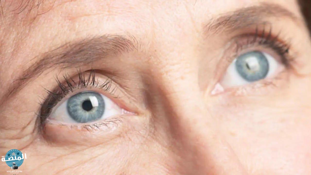 ما هو الجلوكوما مرض المياه الزرقاء في العين