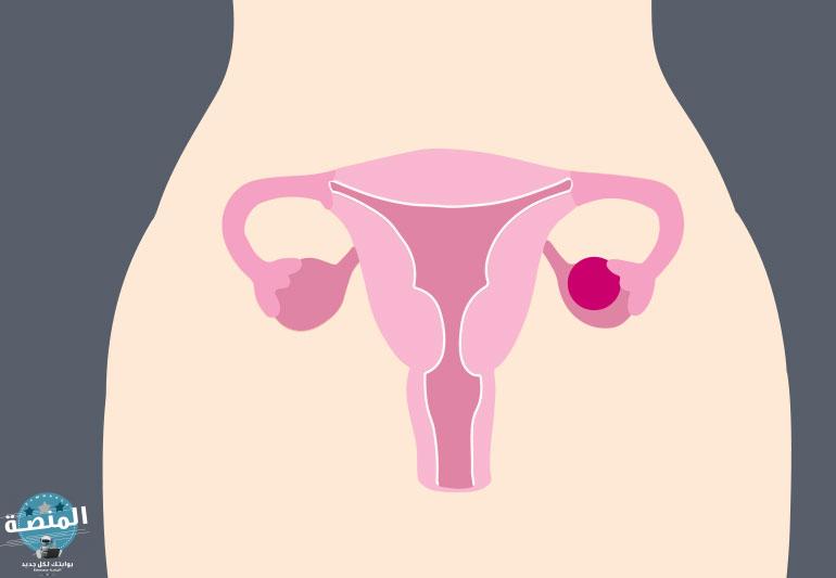ما هو دور بطانة الرحم في حدوث جلطات الدورة الشهرية