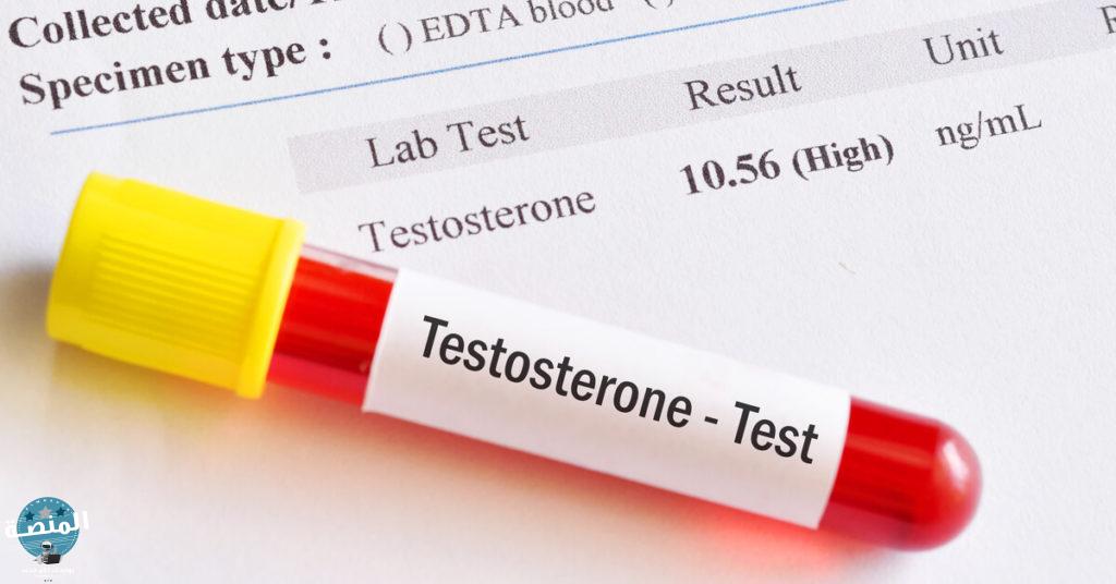 متي يجب اجراء تحليل هرمون التستوستيرون Testosterone Test