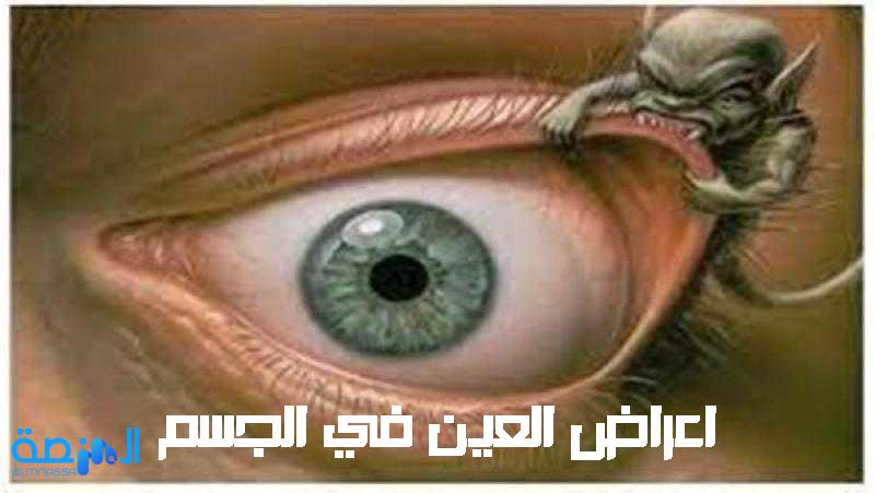 اعراض العين في الجسم