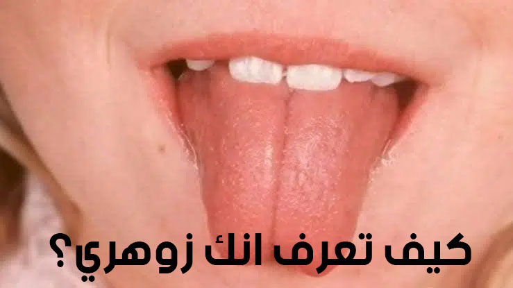 كيف تعرف انك زوهري؟