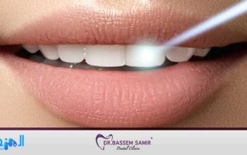 إمكانية تنظيف الأسنان بالفحم والليمون